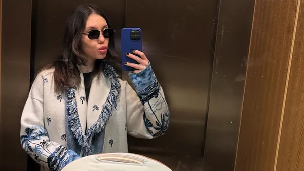 "Ні, не злипнеться": Суркіс в оточенні купи солодкого – пішла у відрив